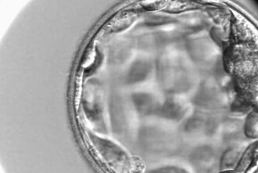 4BB一定比3AC好吗？一文看懂囊胚等级，很多人第一步就理解错了