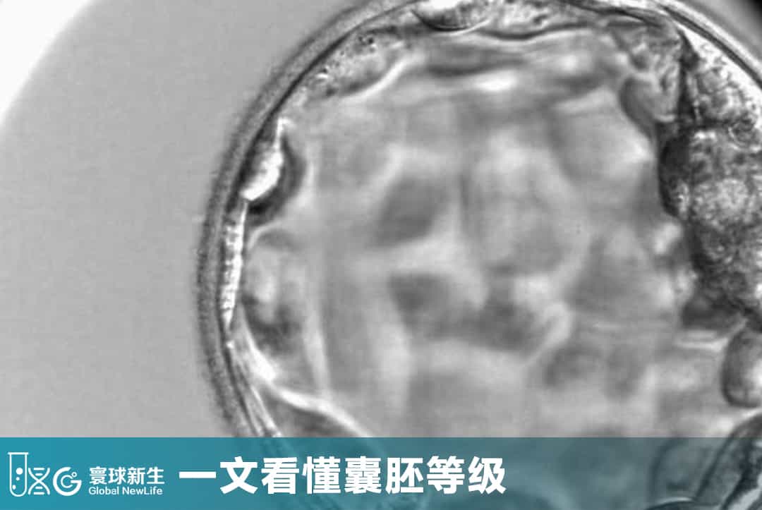 4BB一定比3AC好吗？一文看懂囊胚等级，很多人第一步就理解错了